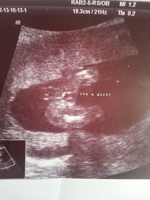 its a girl! what you think