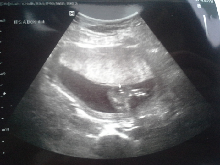 This was at 15 weeks still dont know how they knew it was a boy