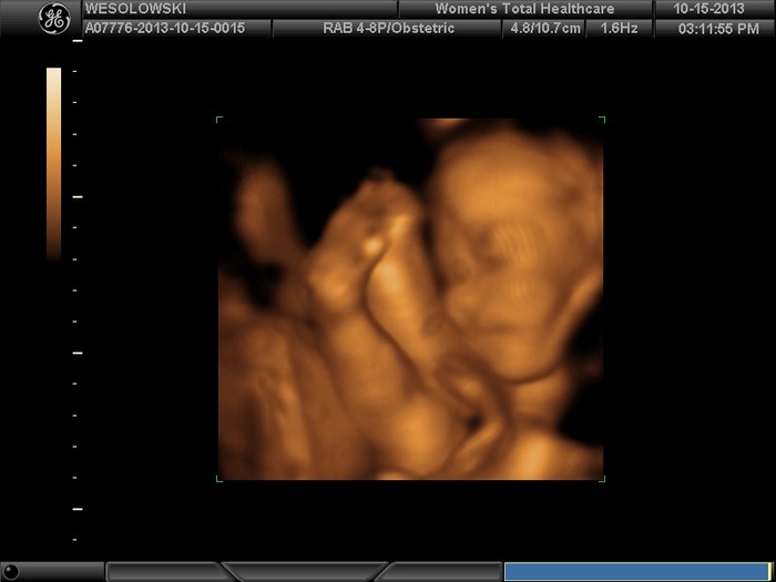 Baby grabbing her lil foot! -27 weeks