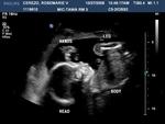 Our Baby Boy punching in the air!