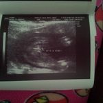20 weeks. It's a girl!