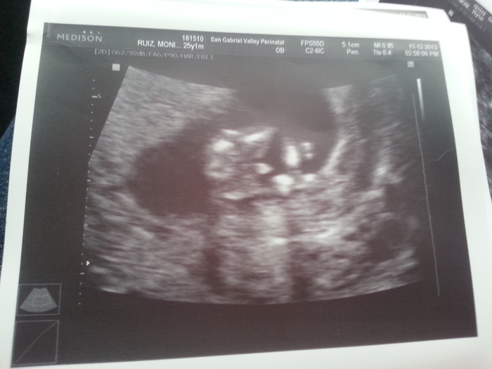 12 weeks (its a boy) 