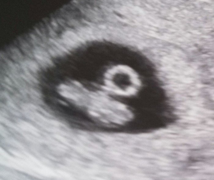 First ultrasound! 7 weeks 1 day <3