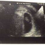 7w2d smudgy little pea :)
