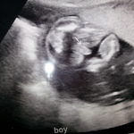 its a boy!