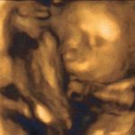 22.5 weeks 4D scan - baby blue's face
