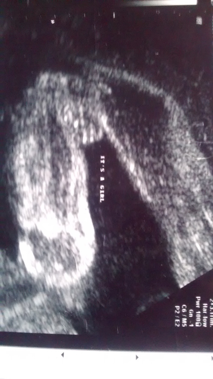 its a girl