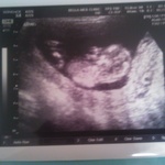 First ultrasound. March 13, 2014. (3 months•5 days) 