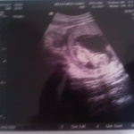 First ultrasound. March 13, 2014.  (3 months•5 days)