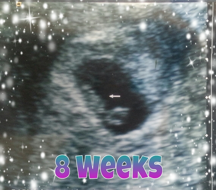 Baby and Sac 8 weeks
