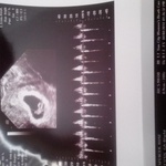 baby and baby heart beat.. 7 weeks 1 day