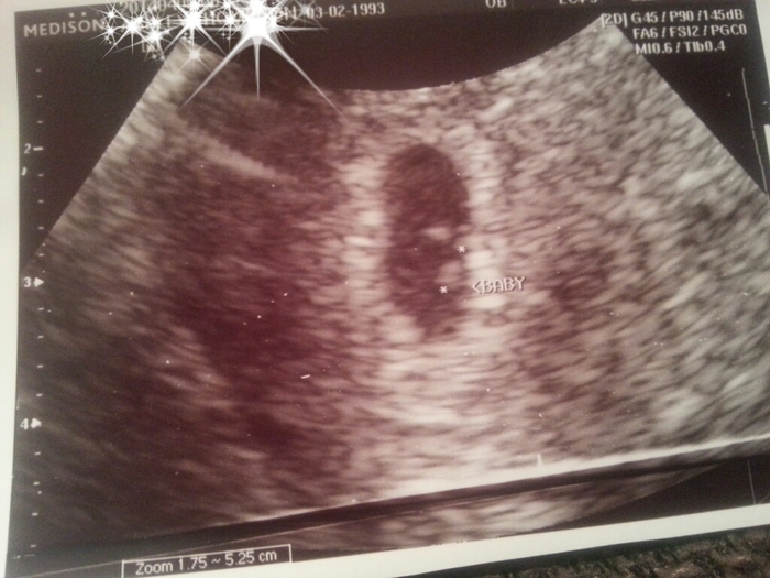 First ultrasound!  6wks