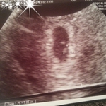 First ultrasound!  6wks