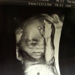 Love his little nose :) 20 with weeks scan