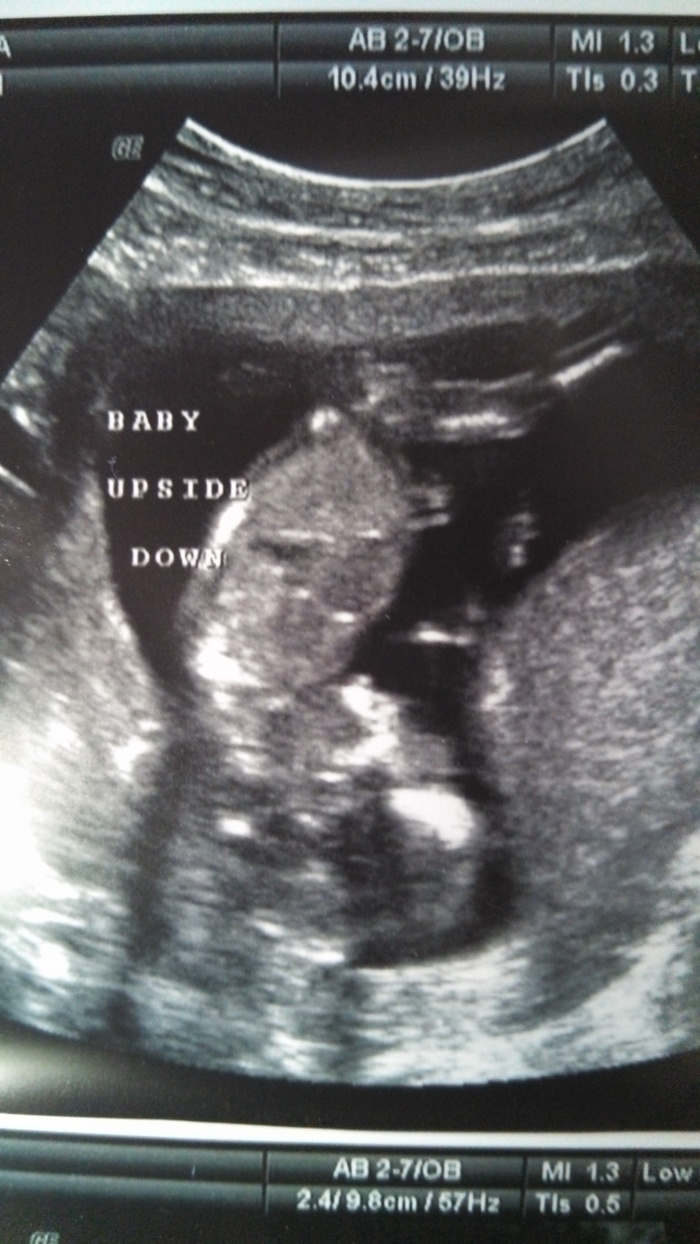 13 week ultrasound :)
