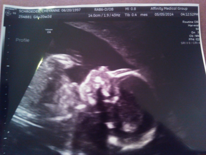 Oh babygirl. <3 (20 weeks•3 days)
