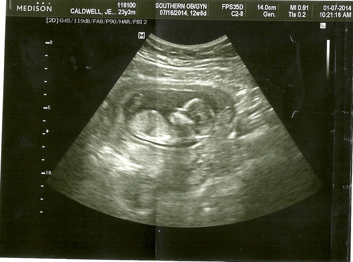 Baby at 12 weeks