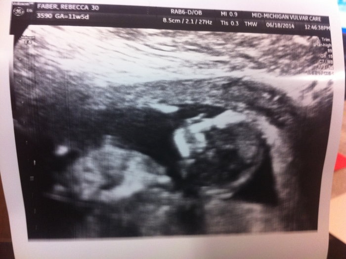 Baby measuring 12 weeks 4 days on June 18th, 2014 =)