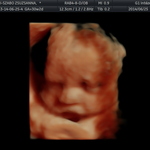 Baby Tommy - week 30