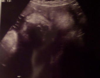 38 week ultrasound :)