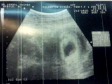 First ultrasound!