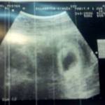 First ultrasound!