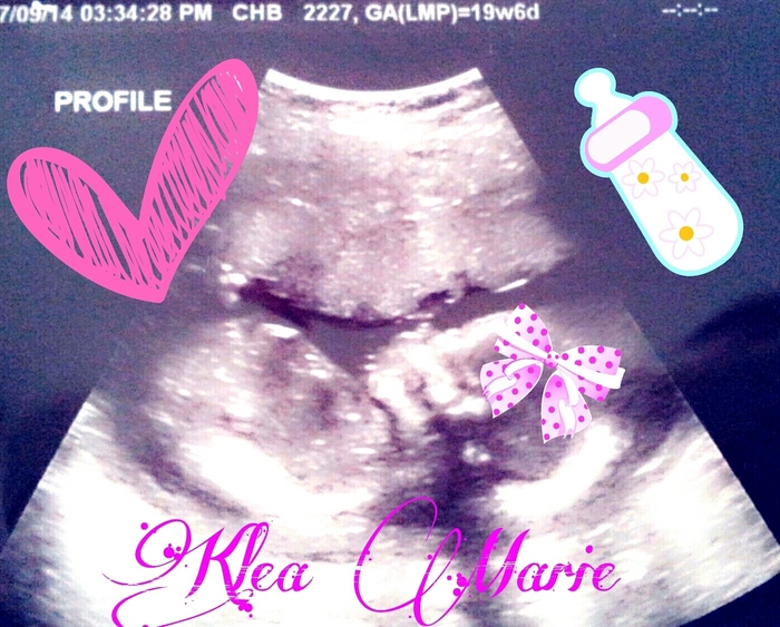 It's a girl! :)