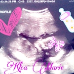 It's a girl! :)