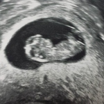 10 weeks 1 day :)