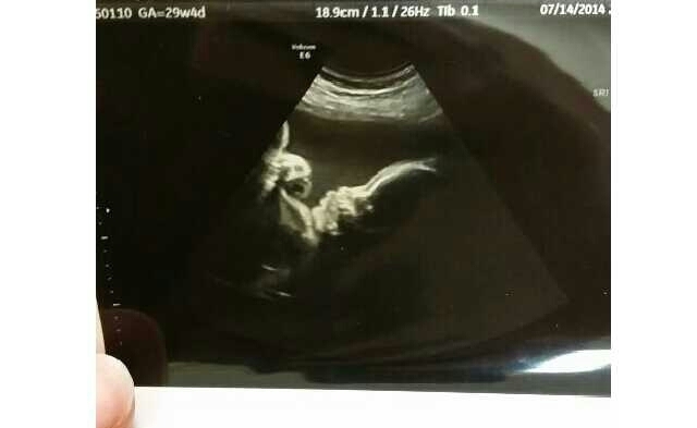 ultrasound at 29 weeks 4 days!