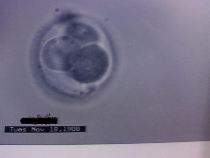 Embryo Transferred 11/18/08!!