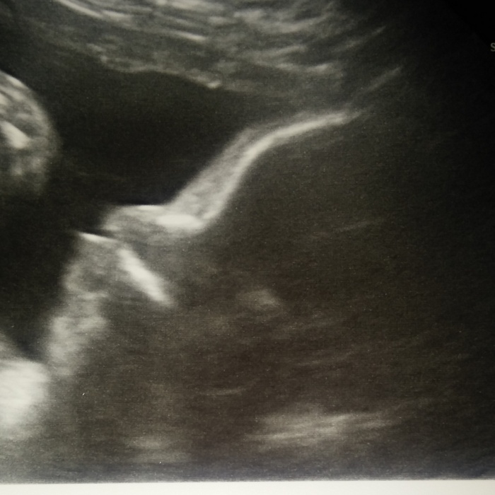 Side Profile is all she would give and she making duck lips lol Grace is 4lbs 2oz so far at 31weeks