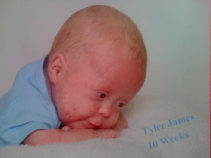 Tyler James 10w old, SMILE