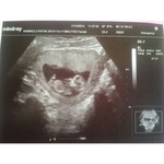 My baby, First Ultrasound 