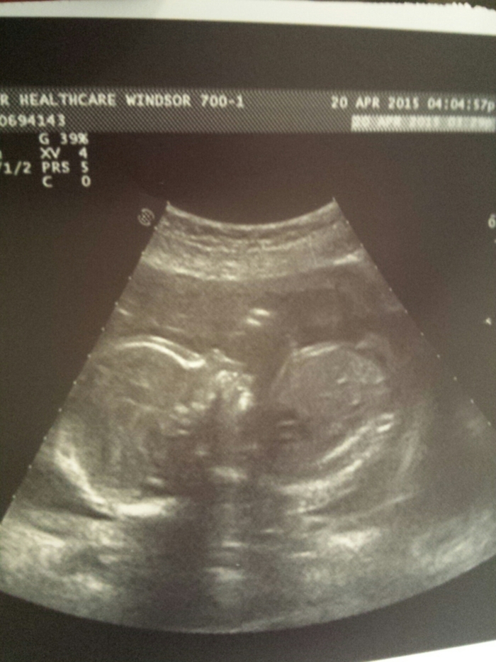 he/she was sucking their thumb almost the whole ultrasound. i cried. cutest thing ever.