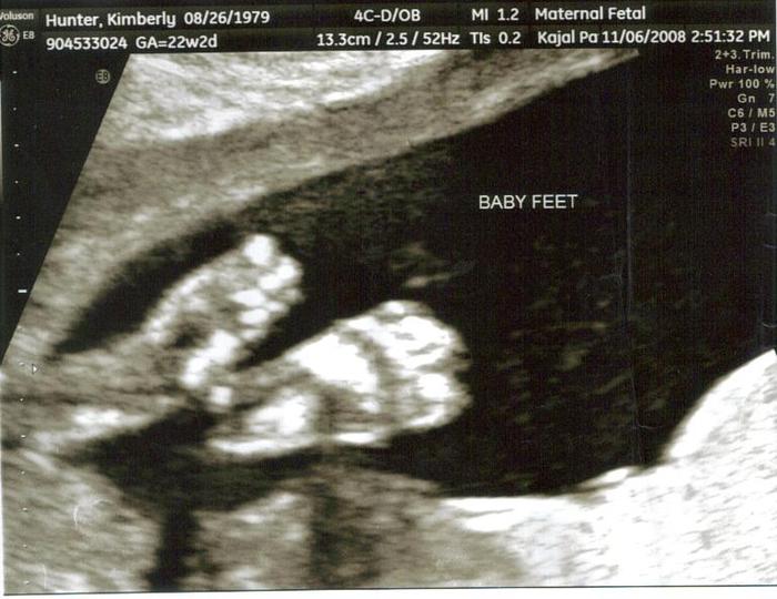 Baby Feet - 22 weeks