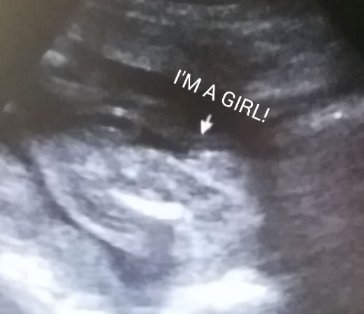 It's a Girl!!!