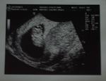 Our little one: 8 weeks and 6 days, heartbeat 174 beats per minute.  Head is upright :)