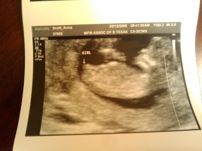 Yep! It's a girl!!!