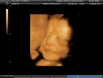 Our baby boy! 3/7/09 - 29 wks!