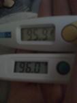 Body Temperature Dysregulation in Dysautonomia...