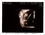 4d ultrasound...ohh my lil bean looks so cute!