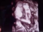 my 3d ultrasound pics at aprox 29 weeks 