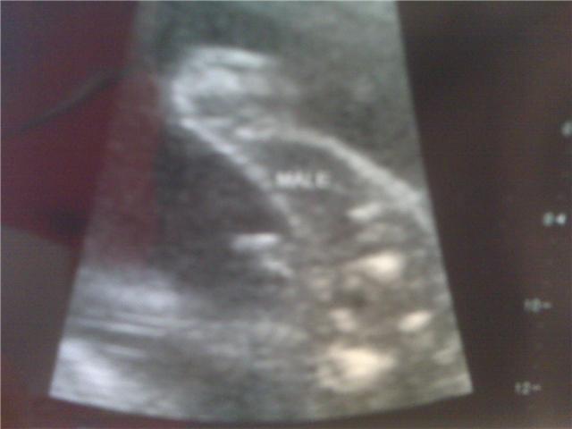 22 week ultrasound, and well endowed :)
