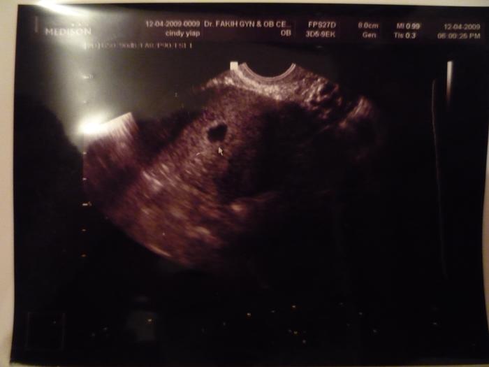 4 weeks plus ultrasound