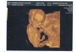 12w 5d our first 4D pic. he has his legs crossed at the ankles and his right hand on his head.