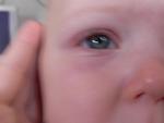 her first boo-boo a black and blue eye... she fell down the stairs = (