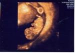 Newest picture of baby keeler - 9w 4d.. 4d ultrasound.. amazing isn't it?