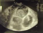 10w3d ultrasound