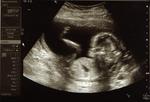 16 weeks : ) Baby Keeler